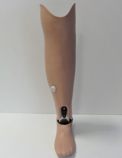 Unterschenkelprothese mit Proprio-Foot-Microprozessor gesteuert